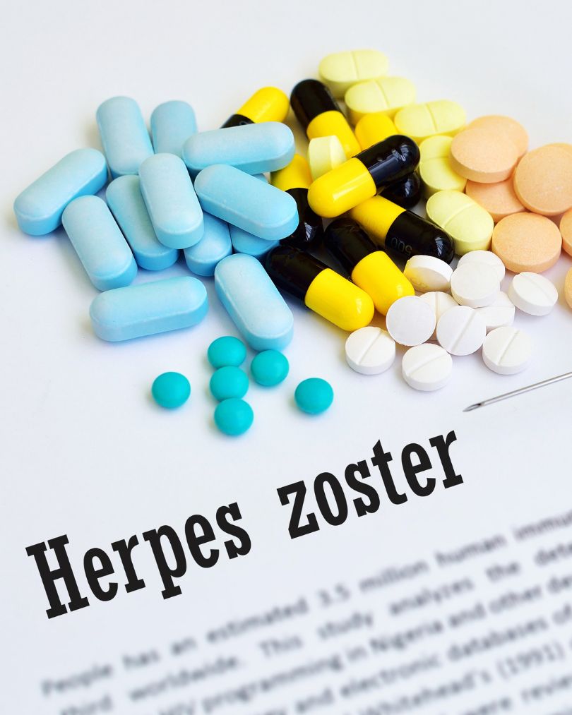 penanganan dan pengobatan herpes zoster